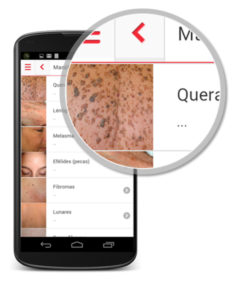 App para autoexplorarse la piel
